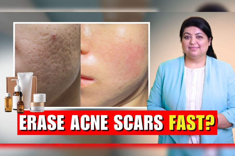 Acne Scar Gels That Actually Work A Dermatologist's Honest Guide